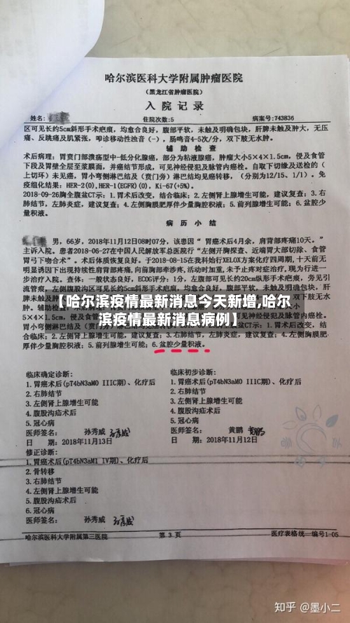 【哈尔滨疫情最新消息今天新增,哈尔滨疫情最新消息病例】-第3张图片