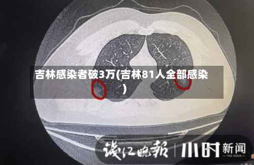 吉林感染者破3万(吉林81人全部感染)-第2张图片